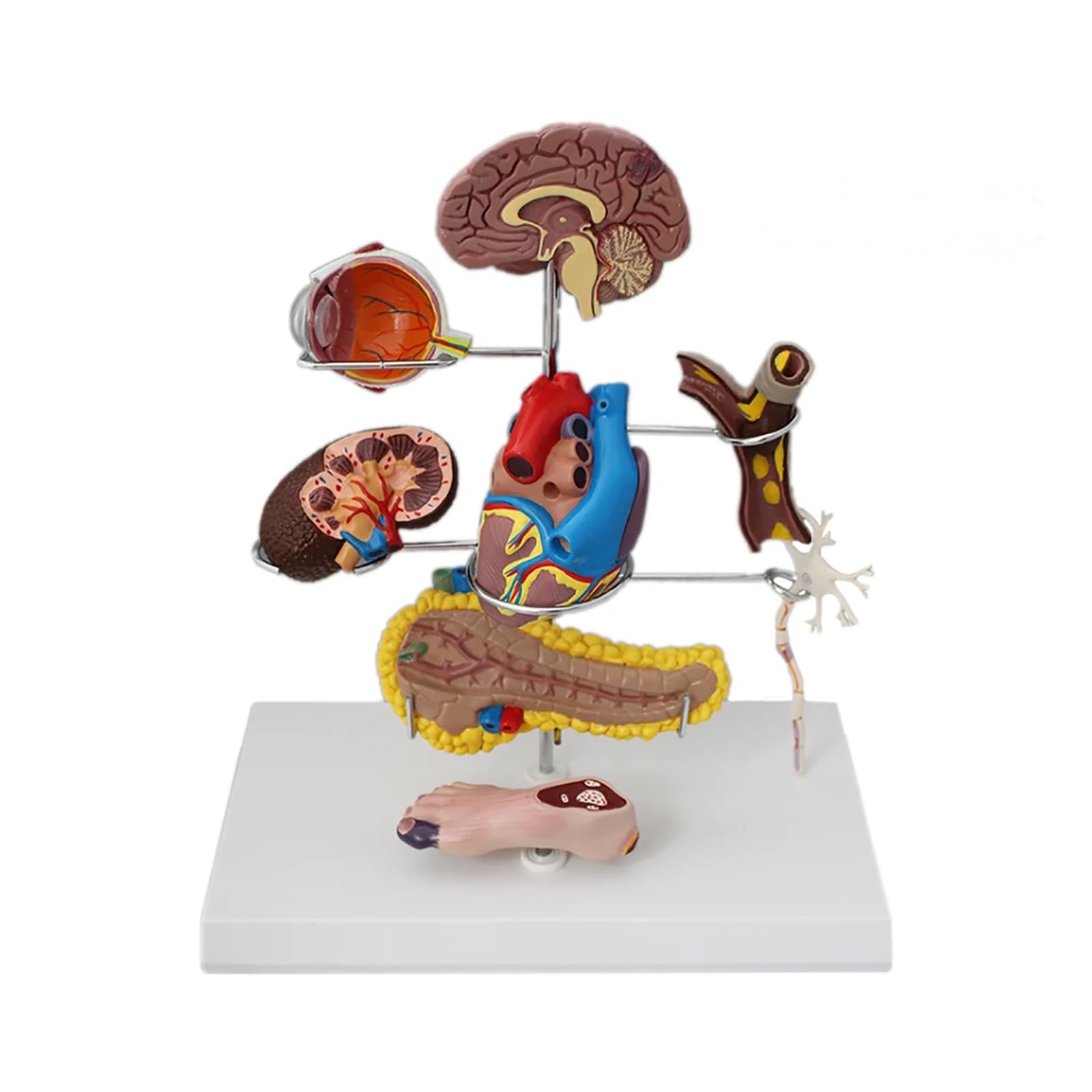 Medyczny Model Cukrzycy, Model Patologii Cukrzycy, Materiał PVC Patologia Cukrzycy Serce, 8 Części Zdejmowany Model Narządu Dla Studentów Anatomii I Fizjologii