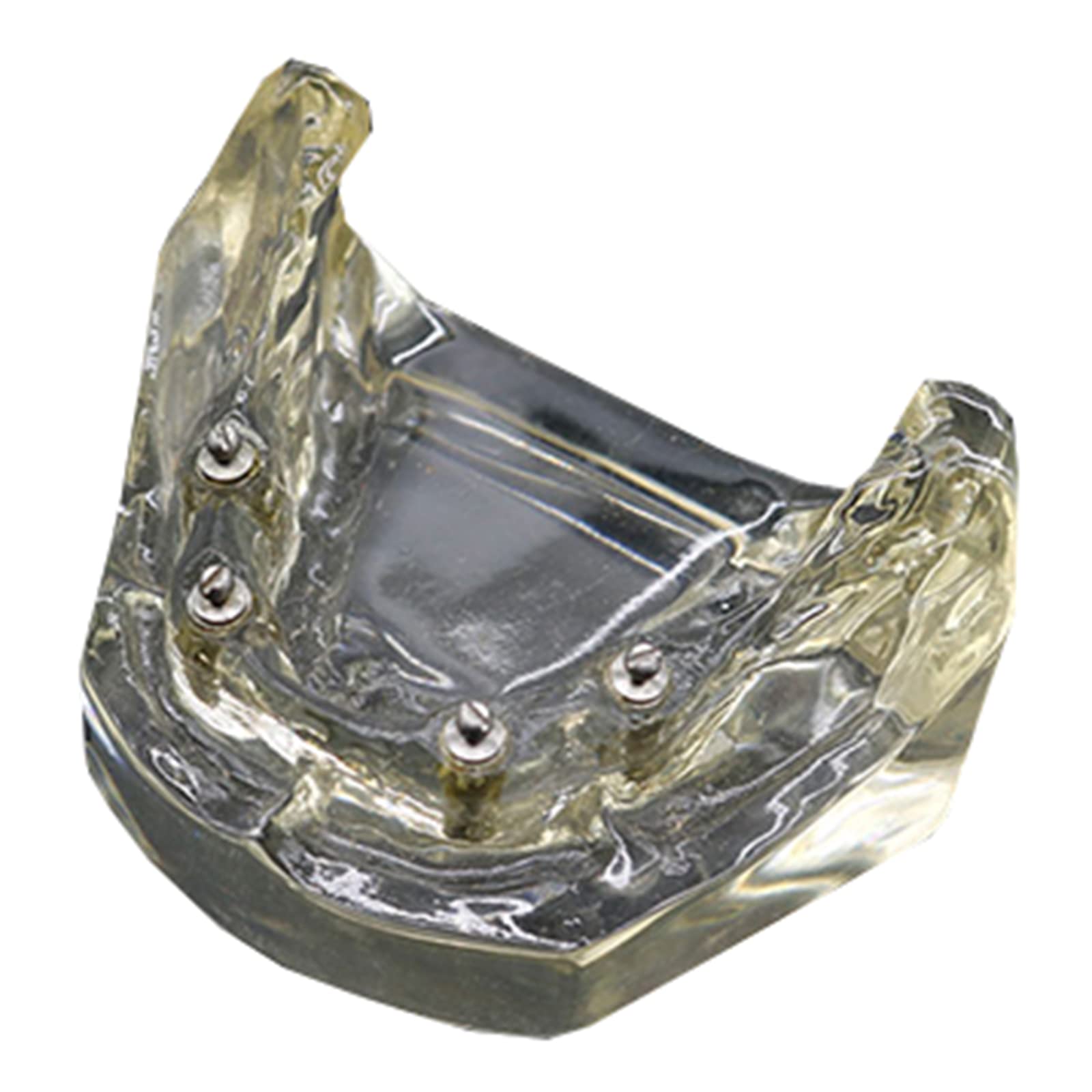 Implant Typodont model zębów - model szkoleniowy implantu dentystycznego - z miękkimi dziąsłami, do nauczania przedmiotów ścisłych, narzędzie komunikacji lekarz-pacjent (B)