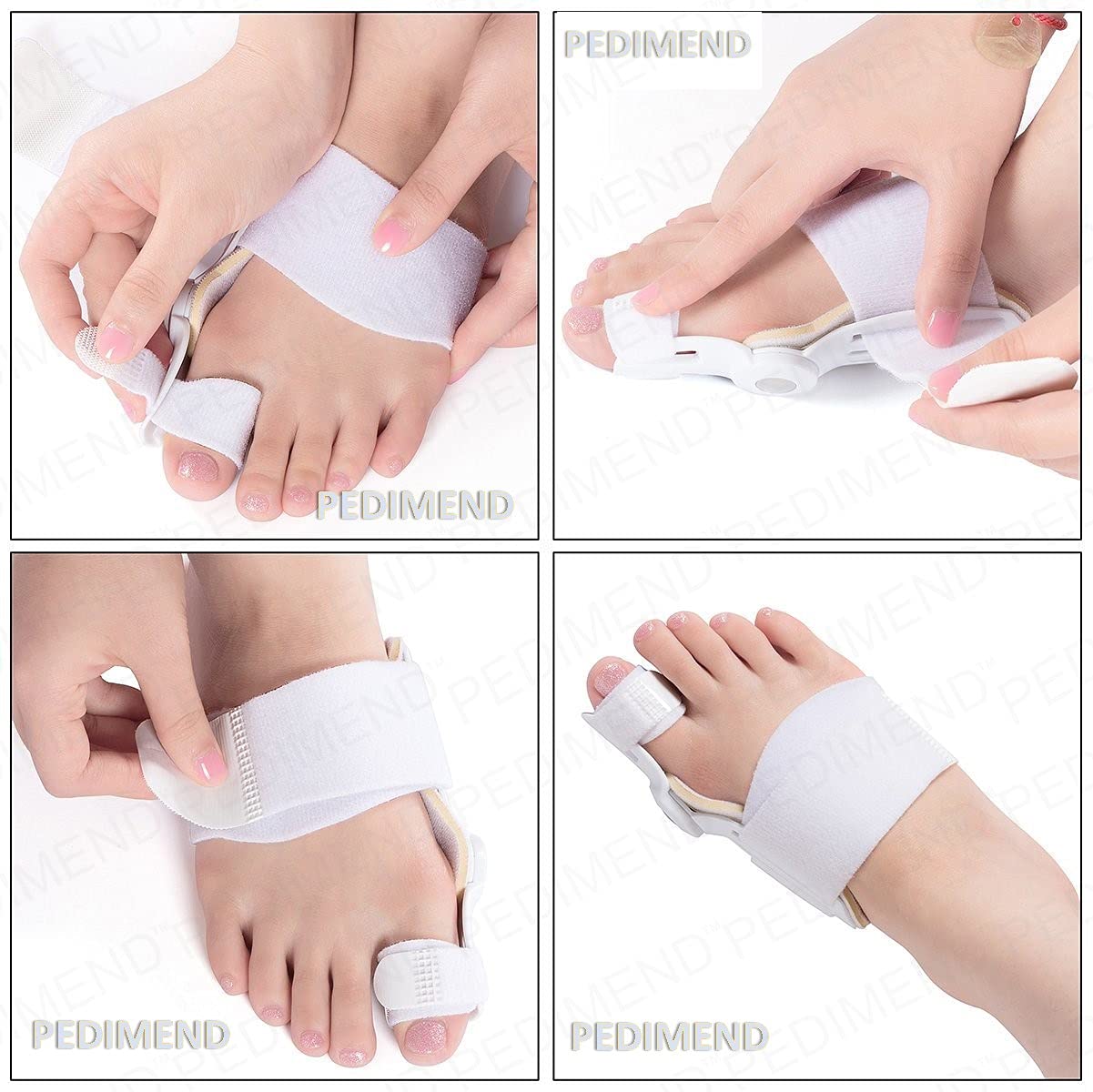 Orthopädische Hallux Valgus Schiene 1 PC von pedimendtm, Hallux Valgus Korrektur Zehen, sanft zu Ihrer natürlichen Position, für Männer und Frauen, eine Größe passend für die meisten, Foot Care