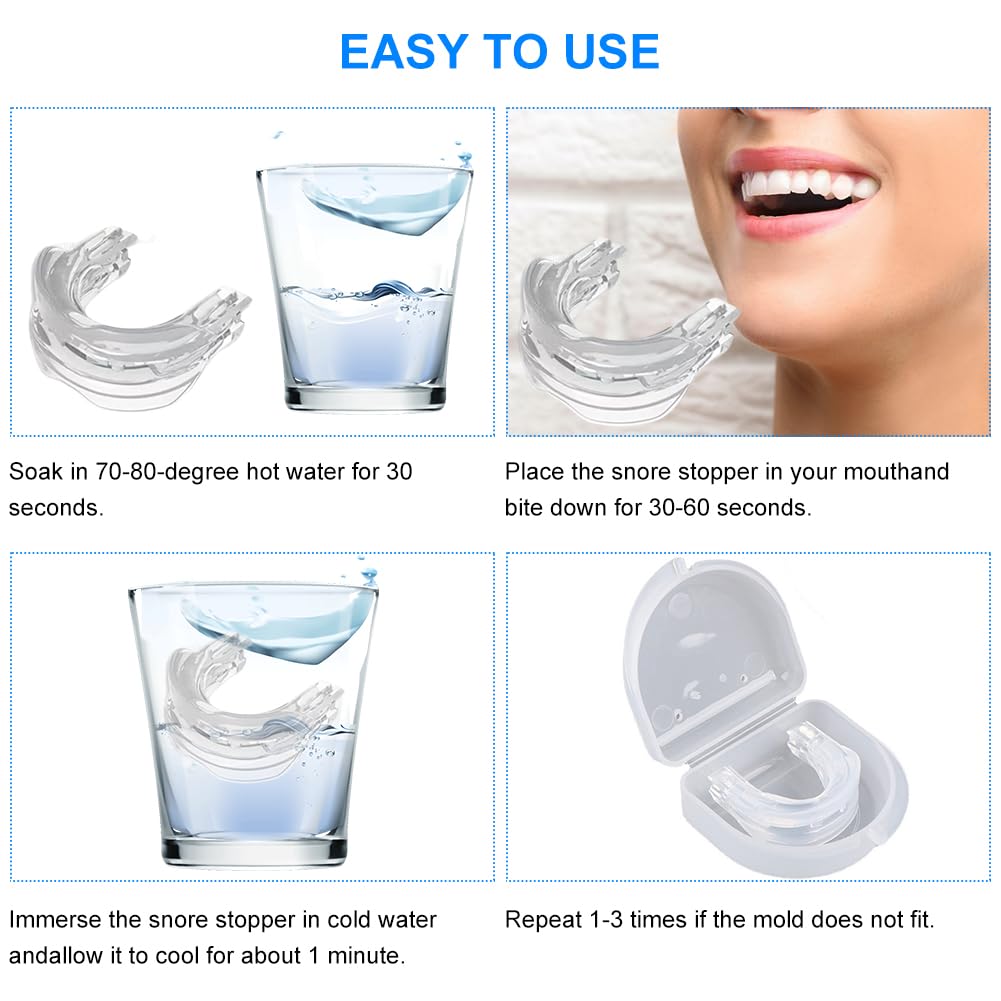 Ferula Antironquidos, Aparato para No Roncar, Dispositivo Antironquidos, Anti Ronquidos para Dormir, Ferula Dental Bruxismo, Anti Snoring Mouth Guard, Protector Dental Dormir, Boquilla Antirronquidos
