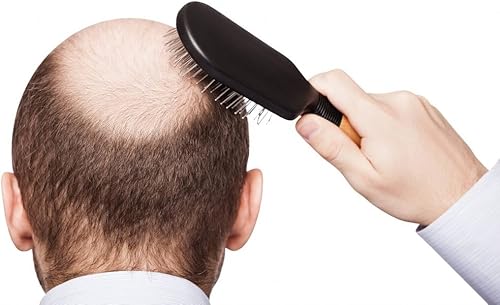 Miniatura 2 de Vitaminas de apoyo al crecimiento del cabello, fórmula bloqueadora DHT para el cabello, apoya el crecimiento saludable del cabello, extracto de he