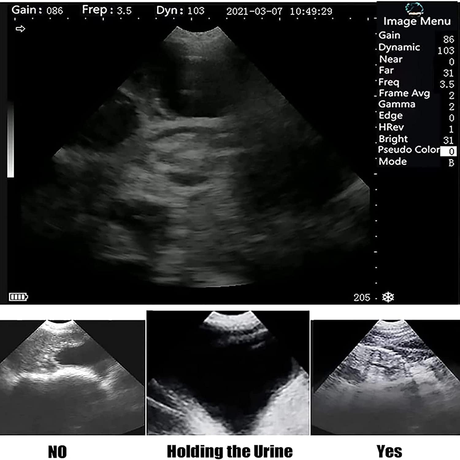 Scanner veterinario portatile ad ultrasuoni | Sonda da 3,5 MHz per pecore maiali e capre | Attrezzatura diagnostica professionale per bestiame B-Scan portatile