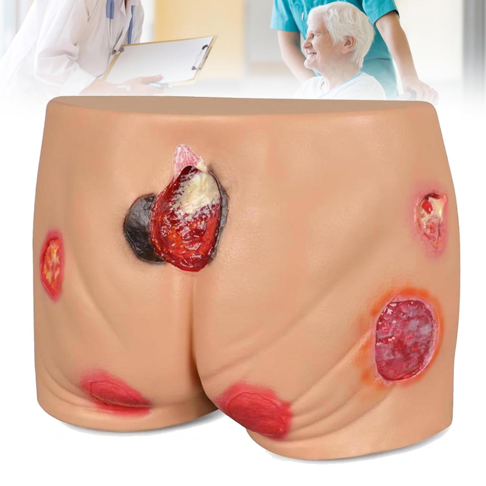 Maniquí de glúteos para entrenar el tratamiento de úlceras por presión con silicona real