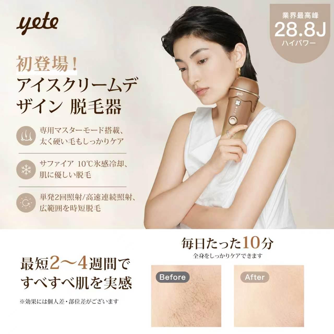 Amazon | YETE 脱毛器 冷感 アイスクリーム脱毛器 10℃恒冷 IPL 湿脱