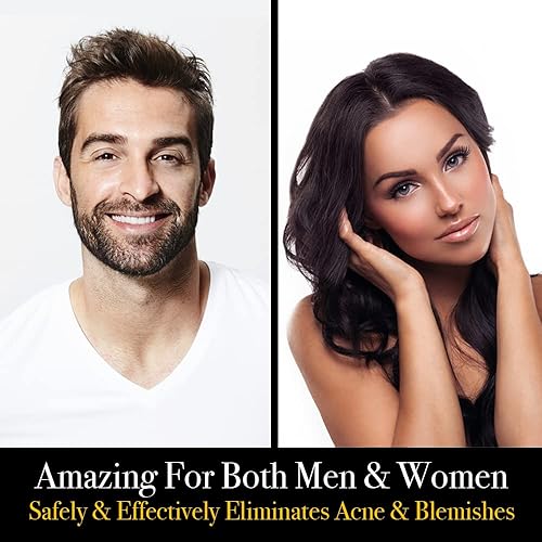 Miniatura 3 de Pete & Pedro Juego de herramientas para el cuidado de la piel para eliminar acné y puntos negros para hombres y mujeres, kit de 5 piezas para