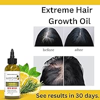 Vista 3 de Aceite de romero para el crecimiento del cabello, infundido con biotina para un crecimiento más rápido del cabello, suero de crecimiento extremo