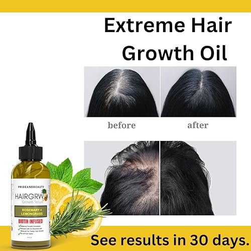 Miniatura 3 de Aceite de romero para el crecimiento del cabello, infundido con biotina para un crecimiento más rápido del cabello, suero de crecimiento extremo del