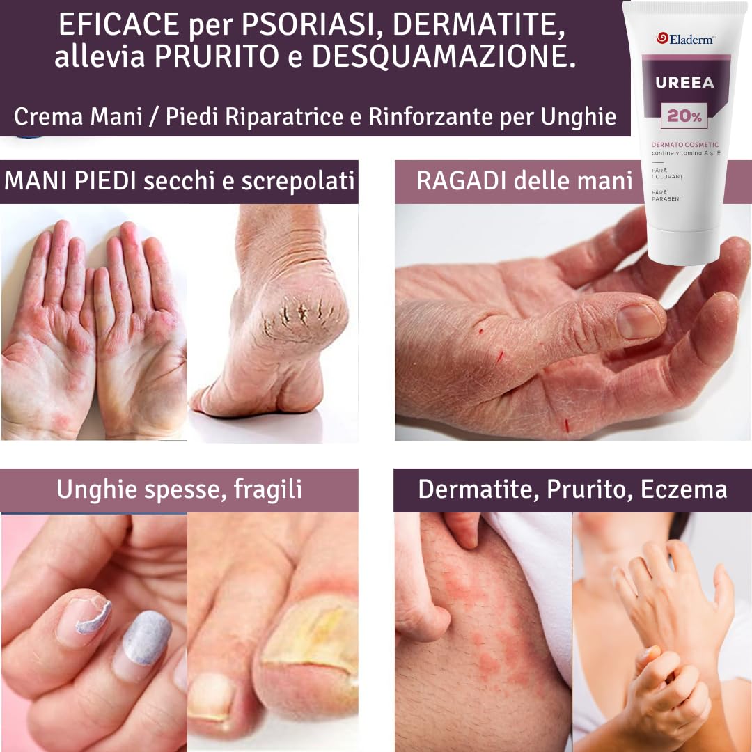 Urea 20% Crema Cheratolitica 100ml – Pelle sogetta a Psoriasi, Dermatite Atopica, Cheratosi, Ipercheratosi - Pelle Molto Secca, Desquamata e Fissurata, Prurito, Irritazioni Superficiali
