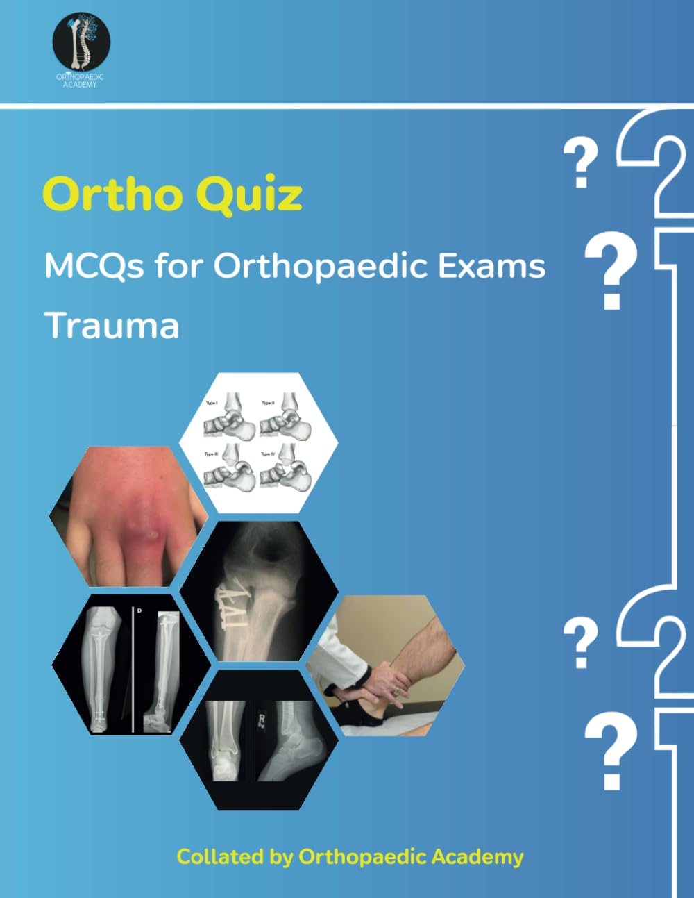 Ortho Quiz: Trauma MCQs