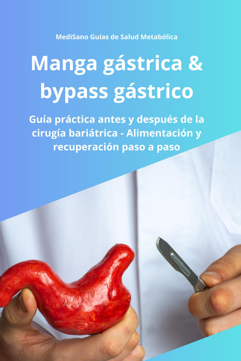 Manga gástrica y bypass gástrico: Guía práctica honesta antes y después de la cirugía bariátrica - Experiencias reales, recuperación, alimentación y ... (MediSano Guías de Salud Metabólica)