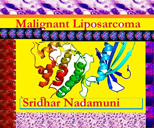 Malignant Liposarcoma (English Edition)