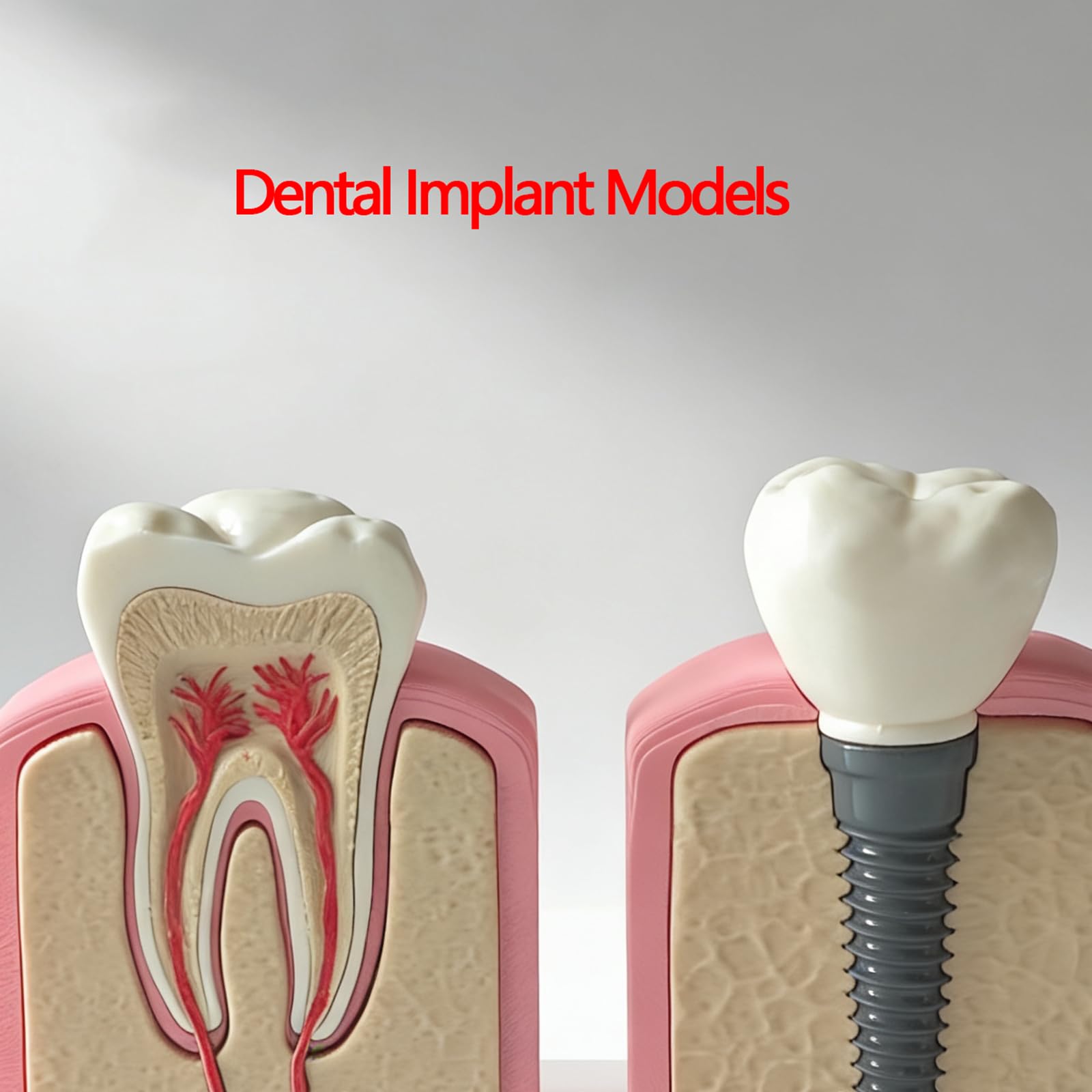 Modello di Dente in Resina per Clinica Ortodontica, Decorazione da Scrivania per Studio Dentistico o Regalo per Ortodontista