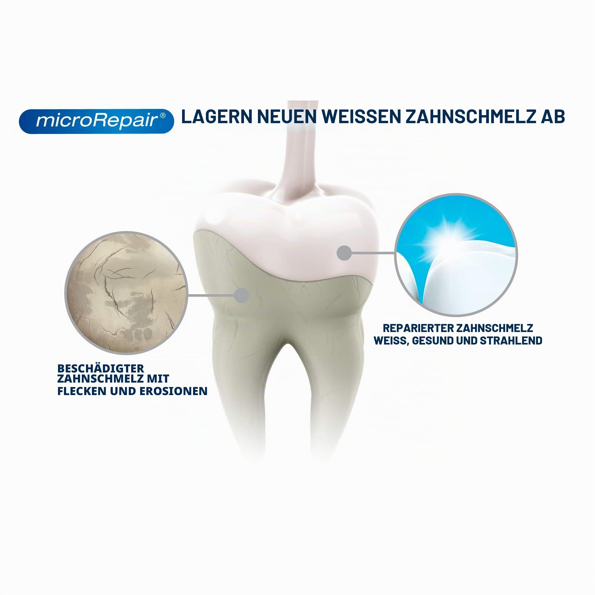Biorepair, Mundspülung für empfindliche Zähne, 3-in-1: antibakteriell, Anti-Karium, Antisensibilität, mit Mikro-Repair und PCA-Zink. Ohne Fluor und Chlorhexidin, Packung mit 500 ml, 6 Packungen