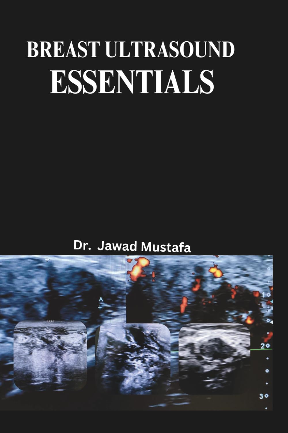 BREAST ULTRASOUND ESSENTIALS      Paperback – August 30, 2025