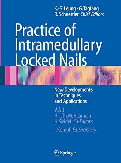 Practice of Intramedullary Locked Nails: New Developments in Techniques and Applications