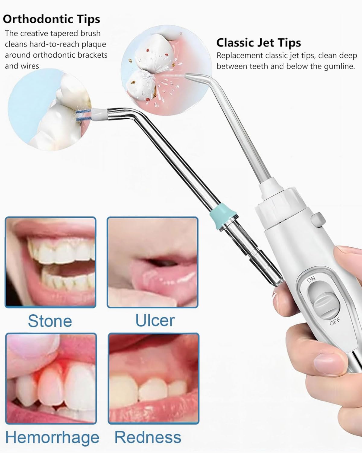 Set di 3 Punte di Ricambio per Idropulsore Dentale, Ugelli Compatibili con perWaterpi WP-100, WP-660 e Altri Modelli, Accessori per Irrigatori Orali, Spruzzo Acqua Dentario