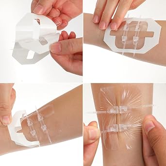 Wound Closure Kit 4 Pcs Wound Closure Strips Butterfly Bandages Stretchable Emergency Laceration Closure Kit for Closing Minor cuts Wounds