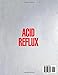 Acid Reflux Diet Cookbook: Manage GERD & LPR with 150 Easy Delicious Recipes. 56-Day Meal Plan for Heartburn Relief and Improved Digestion. Includes Vegan, Smoothie, and Gluten-Free Dessert Chapters