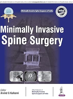 MINIMALLY INVASIVE SPINE SURGERY(OFFICIAL PUBLICATION OF MINIMALLY INVASIVE SPINE SURGEONS OF INDIA)