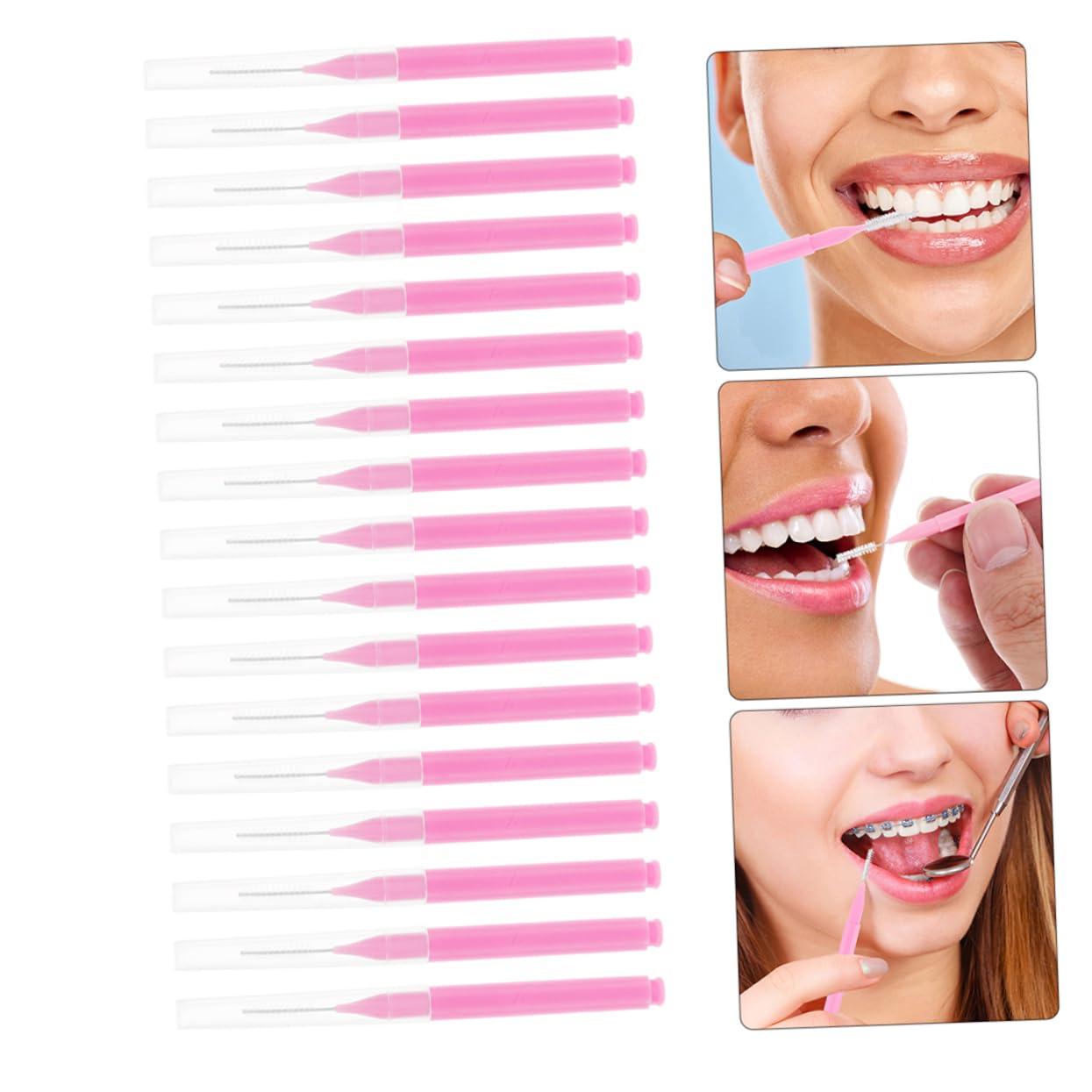 200pezzi Spazzolini Interdentali per Apparecchi Ortodontici Strumenti per Pulizia dei Denti Accessori per Pulizia Interdentale Setole Ultra Morbide Design Ergonomico