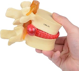 Anatomía humana esqueleto columna lumbar hernia de disco modelo educativo color amarillo