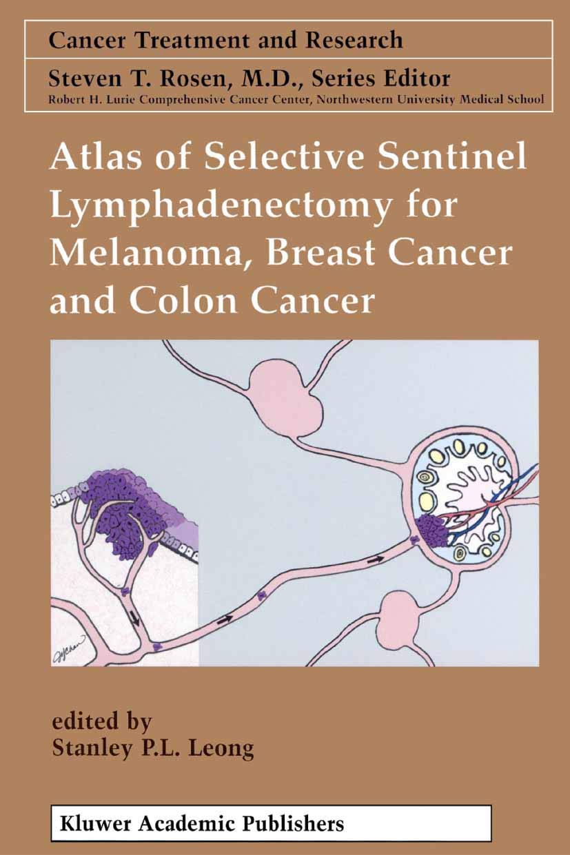 Atlas of Selective Sentinel Lymphadenectomy for Melanoma, Breast Cancer and Colon Cancer (Cancer Treatment and Research Book 111)