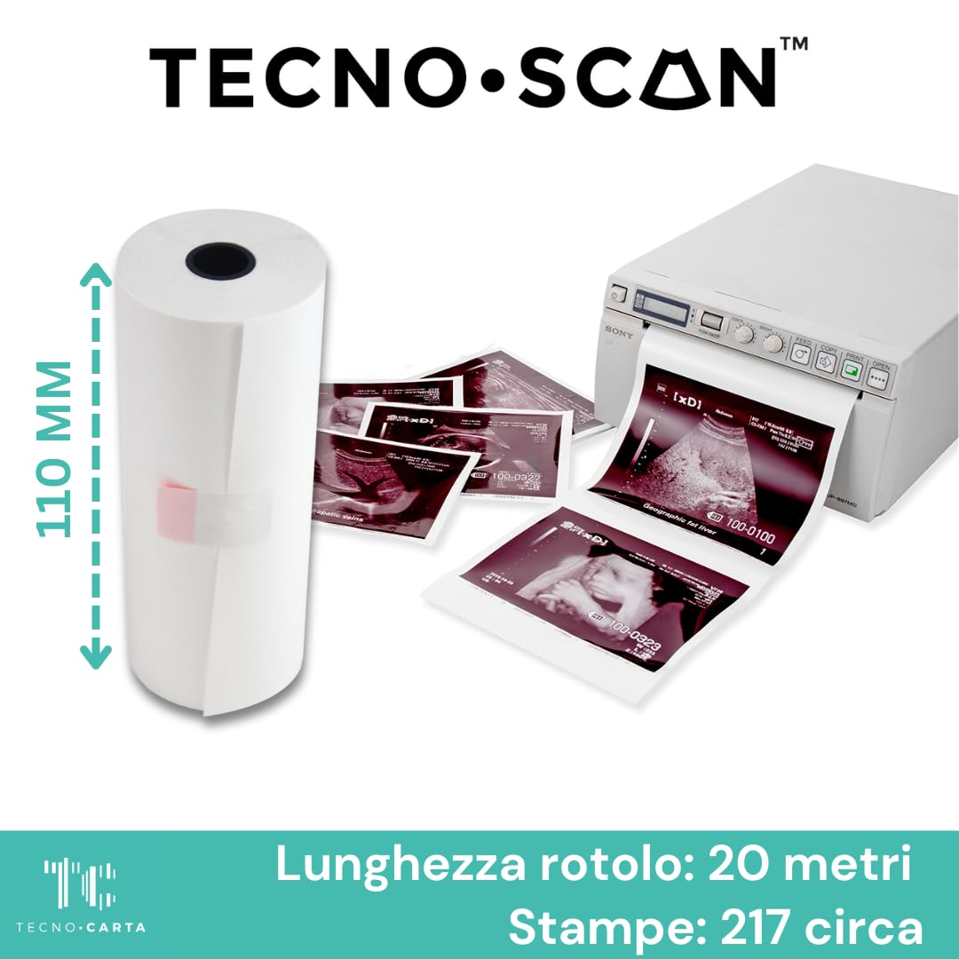 UPP110-S Rotoli Compatibili per Stampanti Ecografiche Sony - Marca Tecnoscan