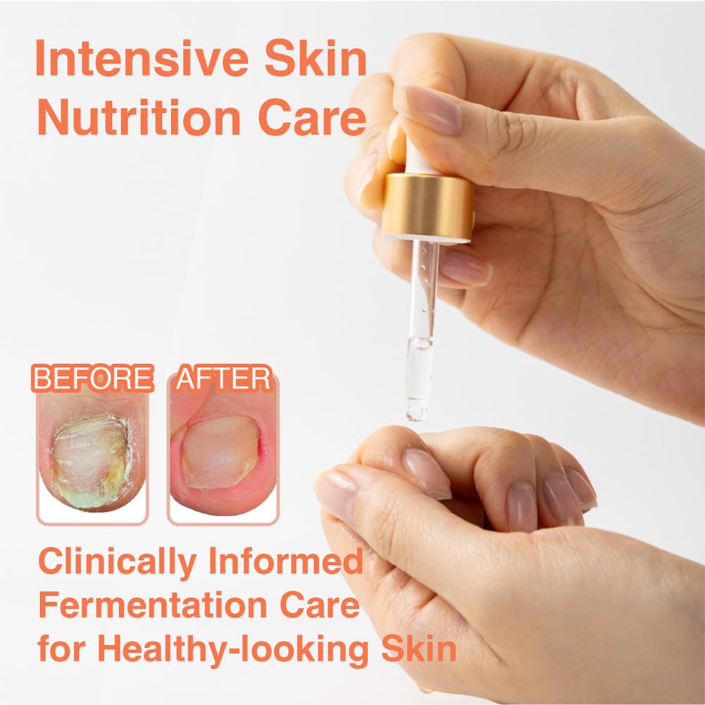 Fermented Nail Oil for Cuticle & Nail Repair | Vegan K-Beauty Serum with Herbal Extracts | Natural Strengthening & Moisturizing Formula for Brittle, Dry Nails | Nourishes, Smooths, Restores | 8ml