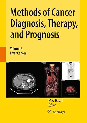 Methods of Cancer Diagnosis, Therapy, and Prognosis: Liver Cancer