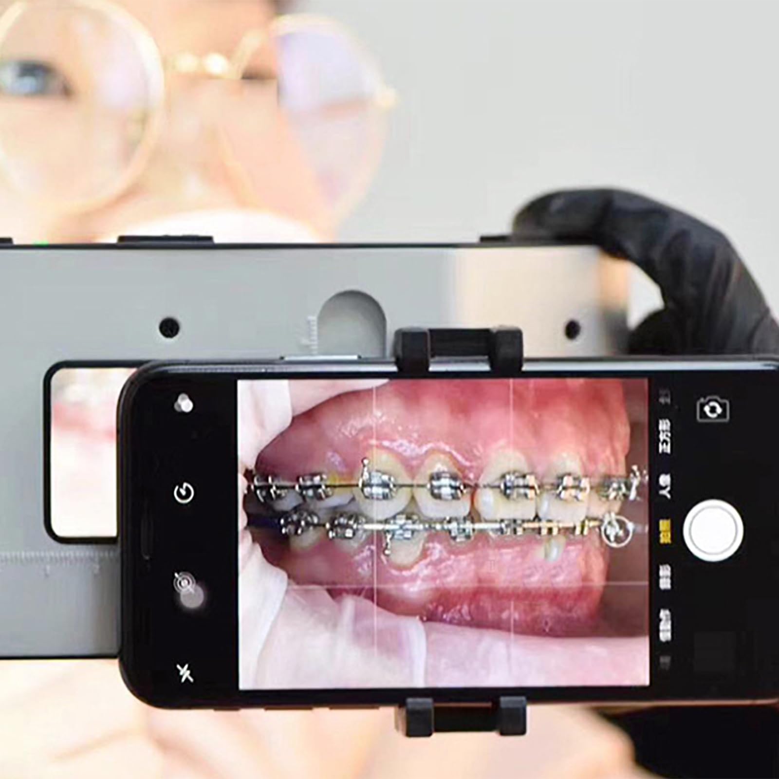 Luz De Relleno Oral, Equipo Fotográfico Dental con Temperatura De Color 6000-6500K, 3 Niveles Ajustables Brillo Y Disparo 360°,Suave Y Uniforme,para Salón Belleza,Hospital Clínico