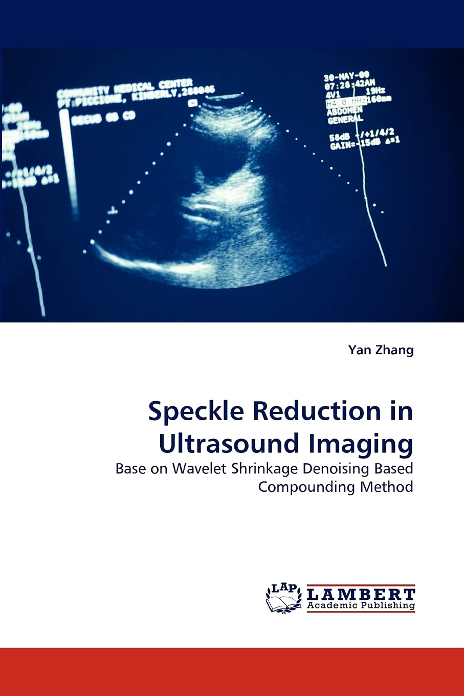 Speckle Reduction in Ultrasound Imaging