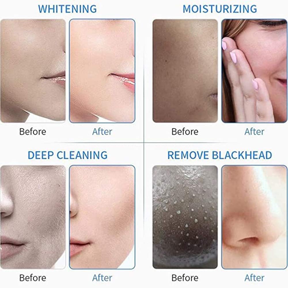Macchina per la Bellezza del Viso all'ossigeno all'idrogen, Hydra Facial Macchina per La Pulizia, 7 in 1 Macchina per La Cura del Viso RF per Uso Facciale, Spa, Casa