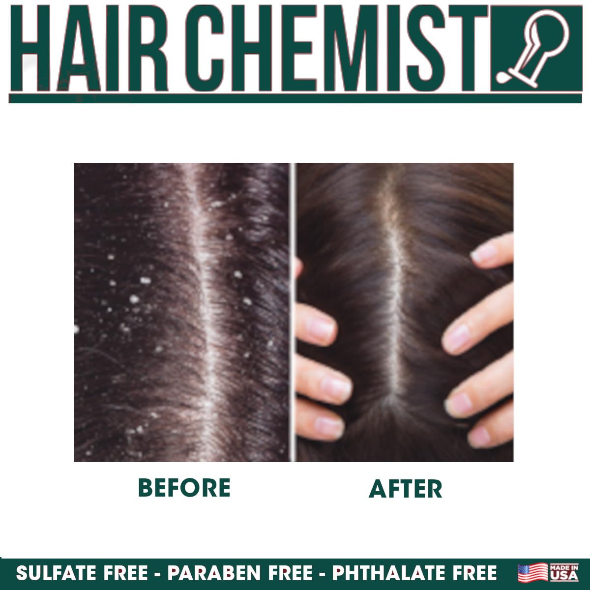 Hair Chemist Szampon miętowy do suchej skóry głowy i łagodzenia swędzenia, 100 ml odżywcza formuła, która łagodzi podrażnienia