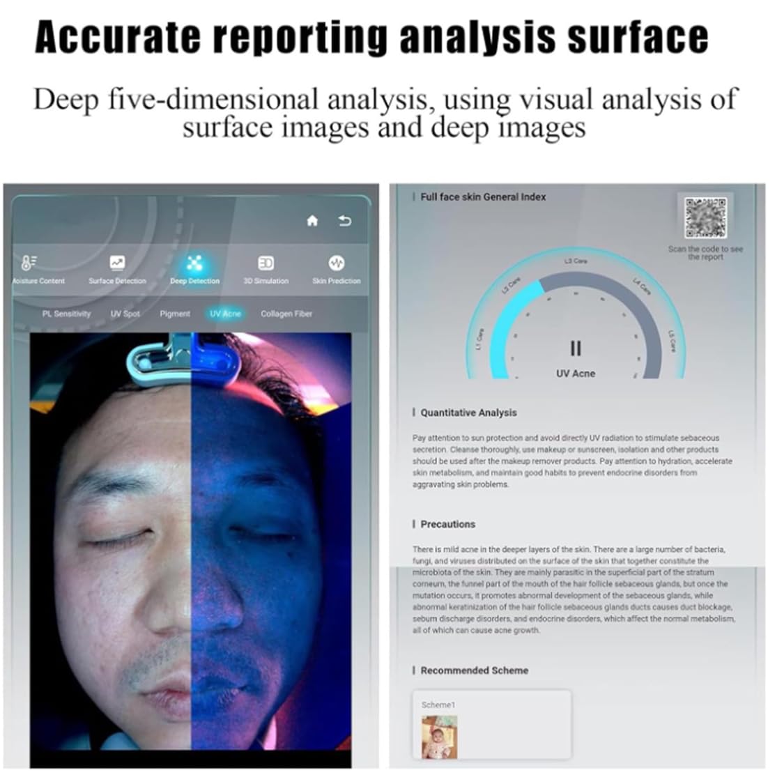 Macchina analizzatrice professionale della pelle, rilevamento e analisi della pelle del viso da 13,3/21,5 pollici, rilevatore intelligente della pelle 3D da 36 milioni di pixel White-13.3inches