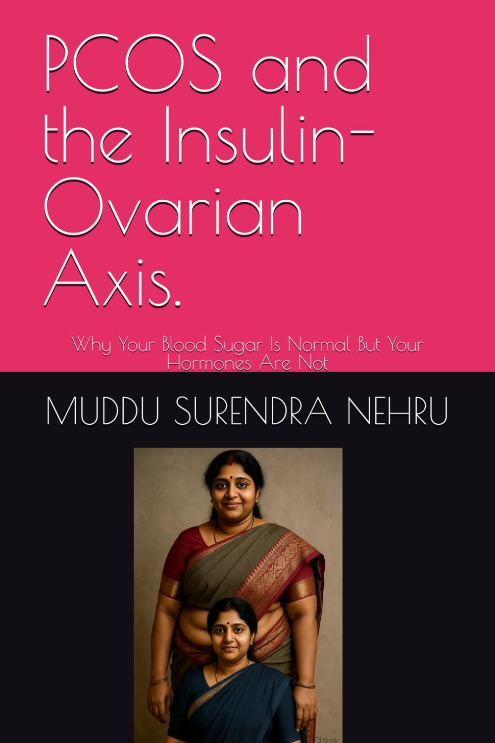 PCOS and the Insulin-Ovarian Axis.: Why Your Blood Sugar Is Normal But Your Hormones Are Not
