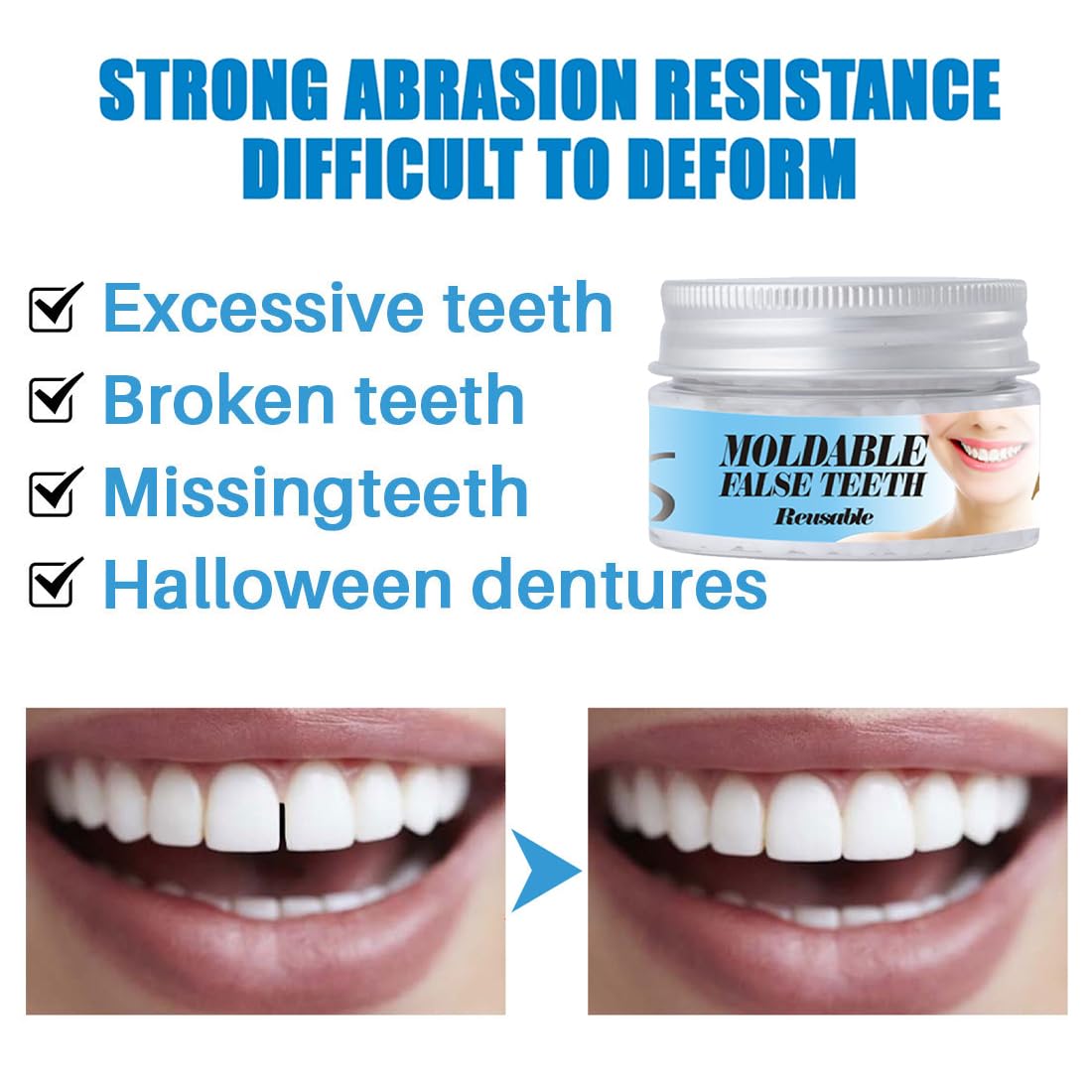 1 Pièces Kit de Réparation Dentaire Provisoire Pansement & Ciment Dentaire, Fixation Temporaire pour Dentier et Fausse Dent Naturelle à Poser, Moulable et Prêt à l'Emploi