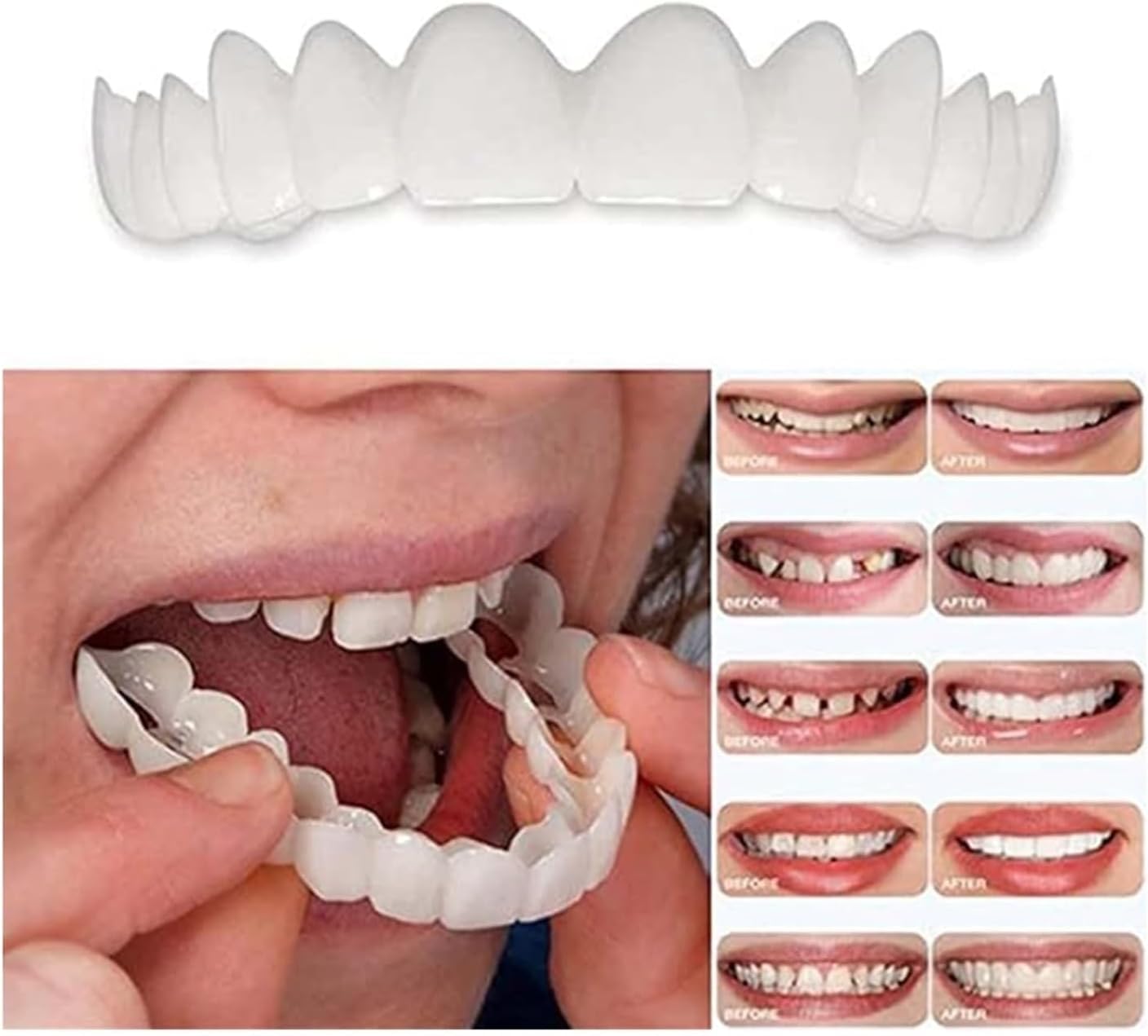 Ajustable para hombres y mujeres, arregla tu sonrisa en casa en cuestión de minutos (2 pares) (2)