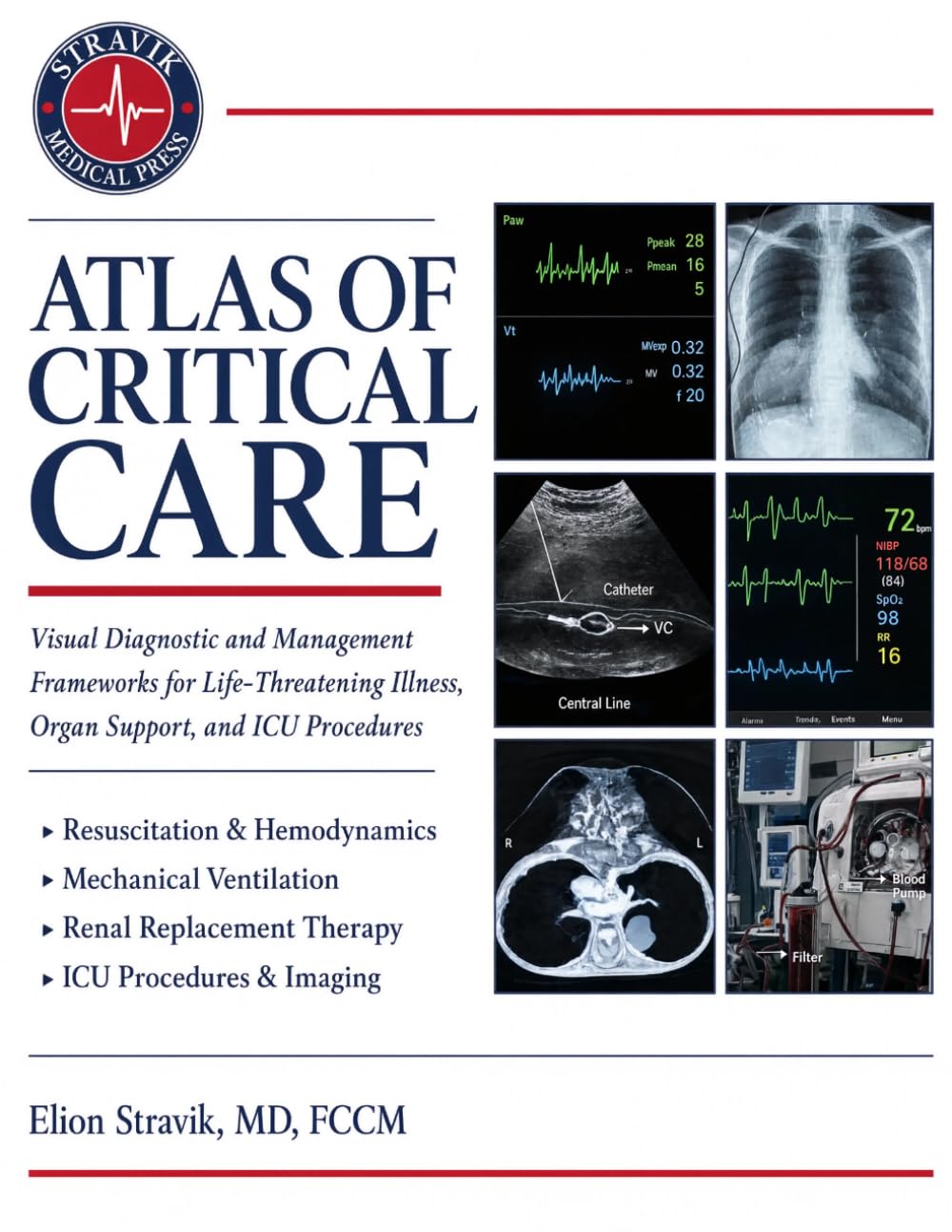 ATLAS OF CRITICAL CARE: Visual Diagnostic and Management Frameworks for Life-Threatening Illness, Organ Support, and ICU Procedures