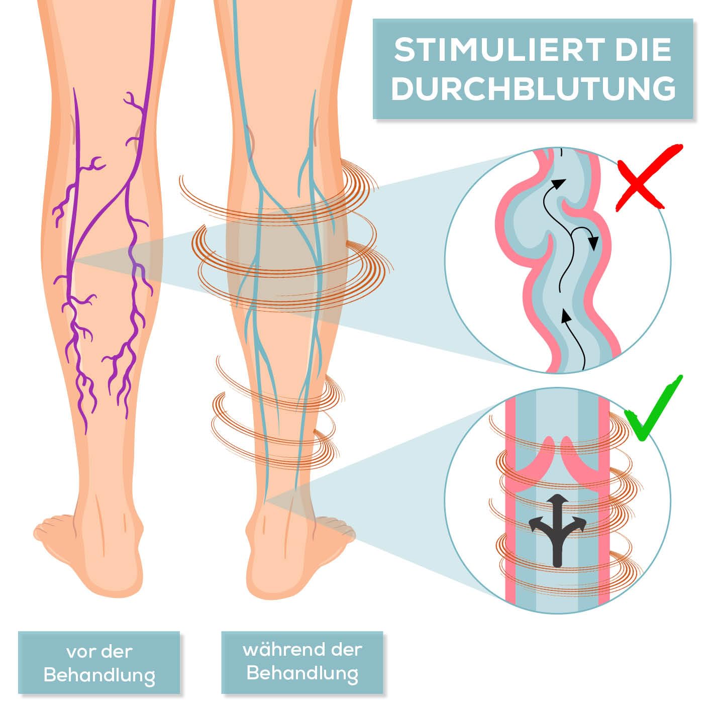 EMS Blutzirkulationsstimulator | zertifizierte medizinische Geräte + 4 EMS-Pads | Blutzirkulation in den Beinen | Mit Fernbedienung | Variable Intensität