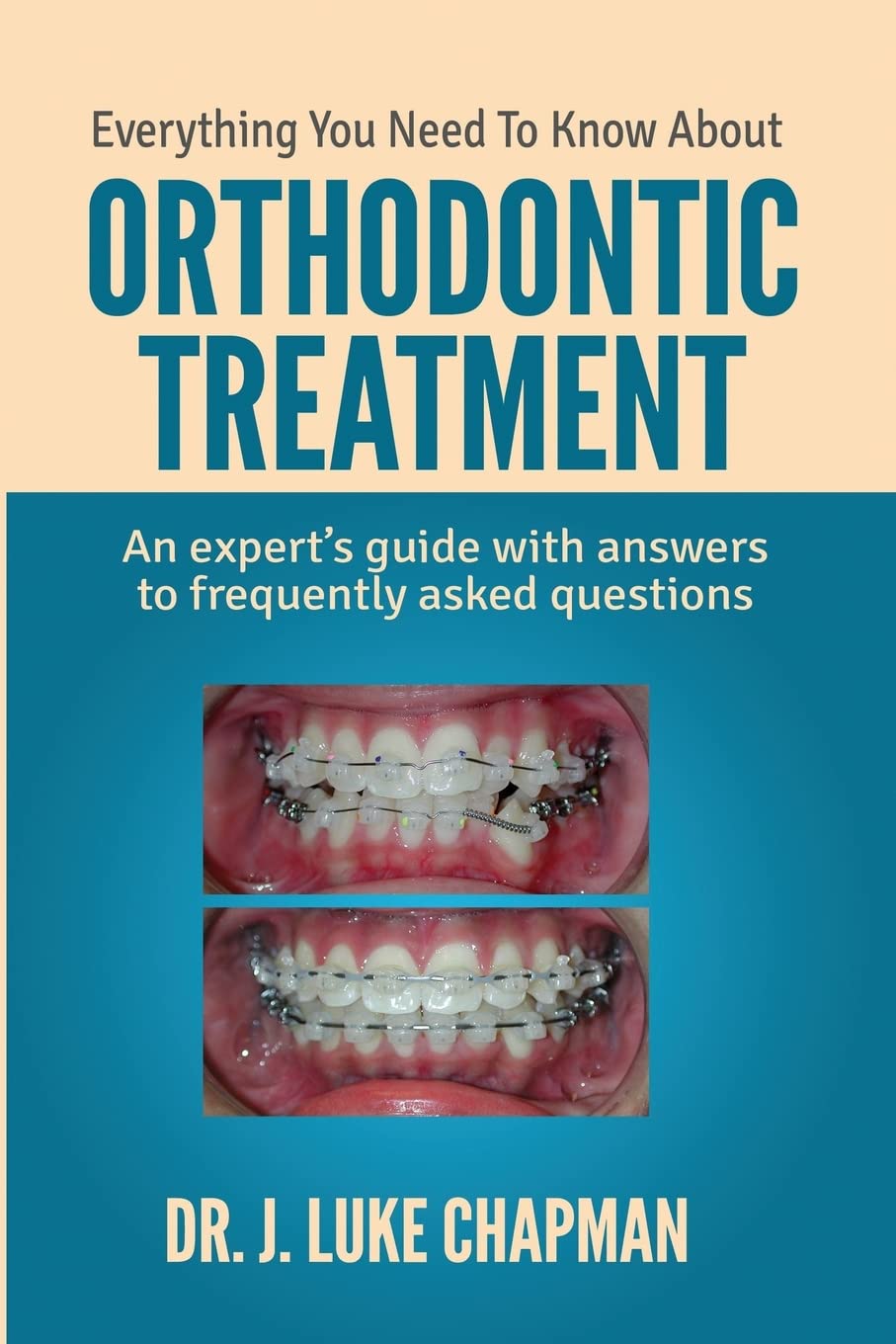Everything You Need To Know About Orthodontic Treatment: An expert's guide with answers to frequently asked questions