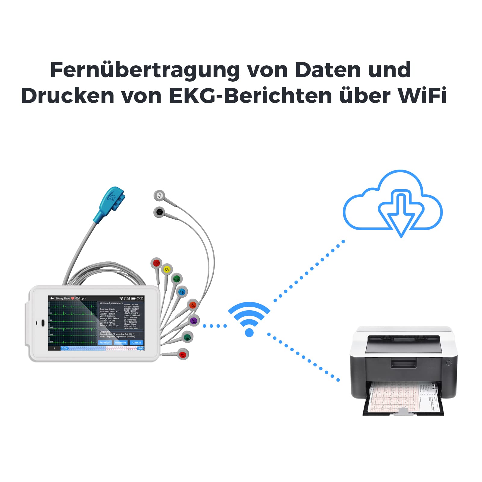 CheckMe ECG profesional de 12 derivaciones, ECG digital con algoritmo de Glasgow, adquisición y análisis de datos de ECG en tiempo real, transferencia de datos por WIFI e impresión de informes