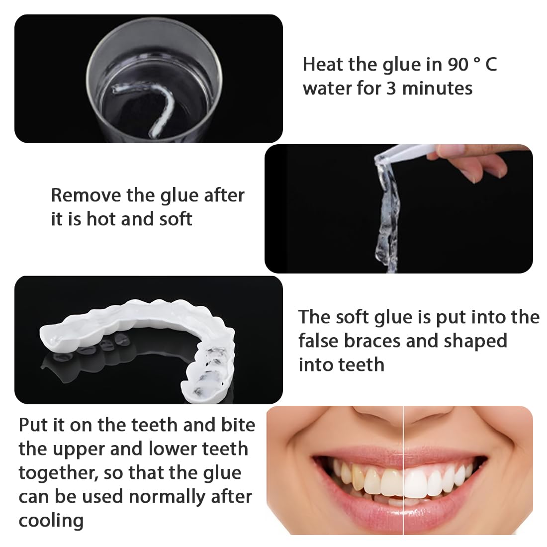 2 Coppie Faccette Denti, Faccette Denti Finti a Scatto Superiore e Inferiore, accette Denti Cosmetici,Protesi Dentarie Cosmetici Temporanee,per Uomini e Donne Copertura di Denti Imperfetti