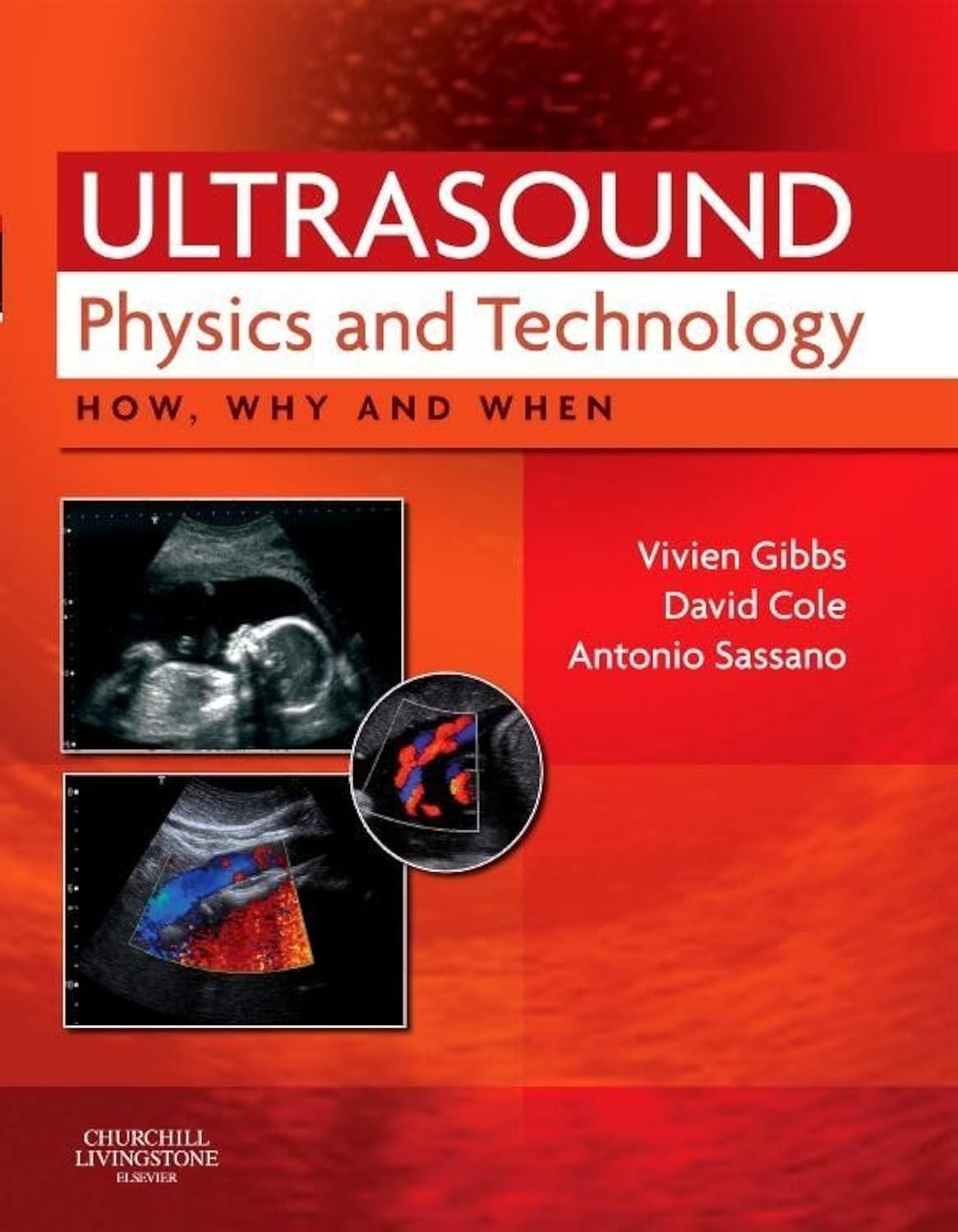 Ultrasound Physics and Technology How, Why and When Gibbs Cole Sassano Hardback