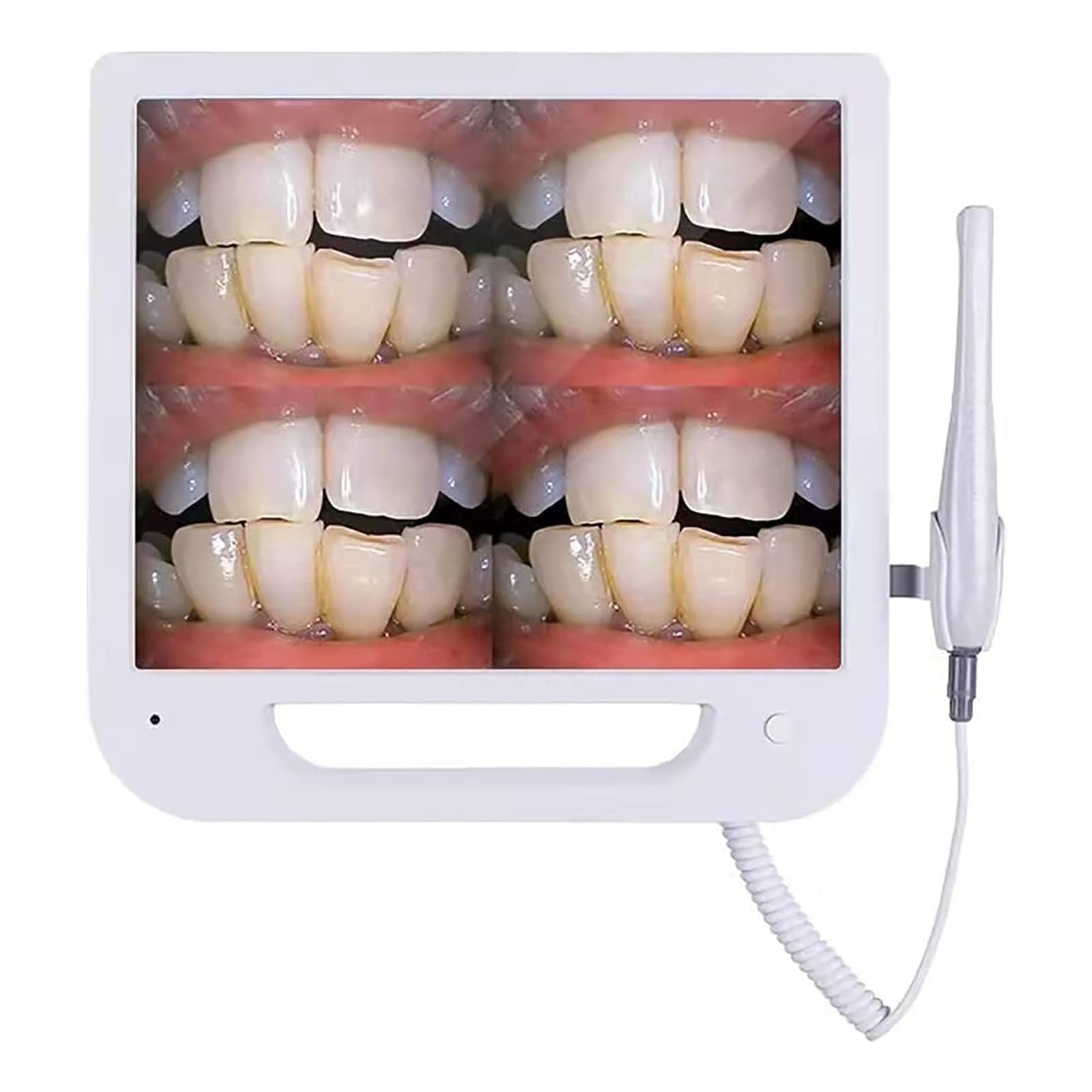 Telecamera Intraorale Dentale, Telecamera Endoscopica Medica Telecamera Intraorale Dentale, VGA con Monitor da 17 Pollici/Scanner Intraorale Digitale CMOS Odontoiatria