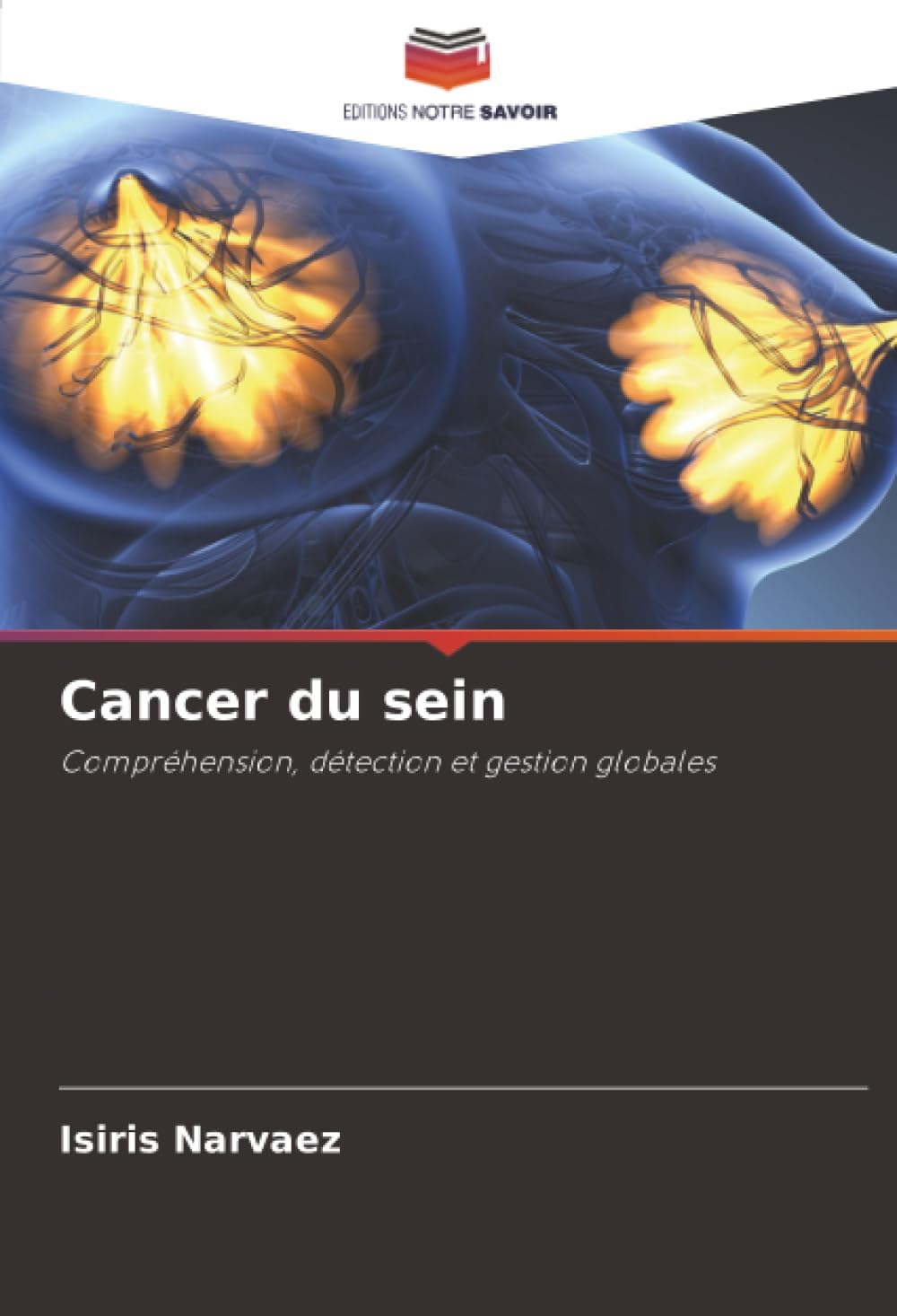 Cancer du sein: Compréhension, détection et gestion globales