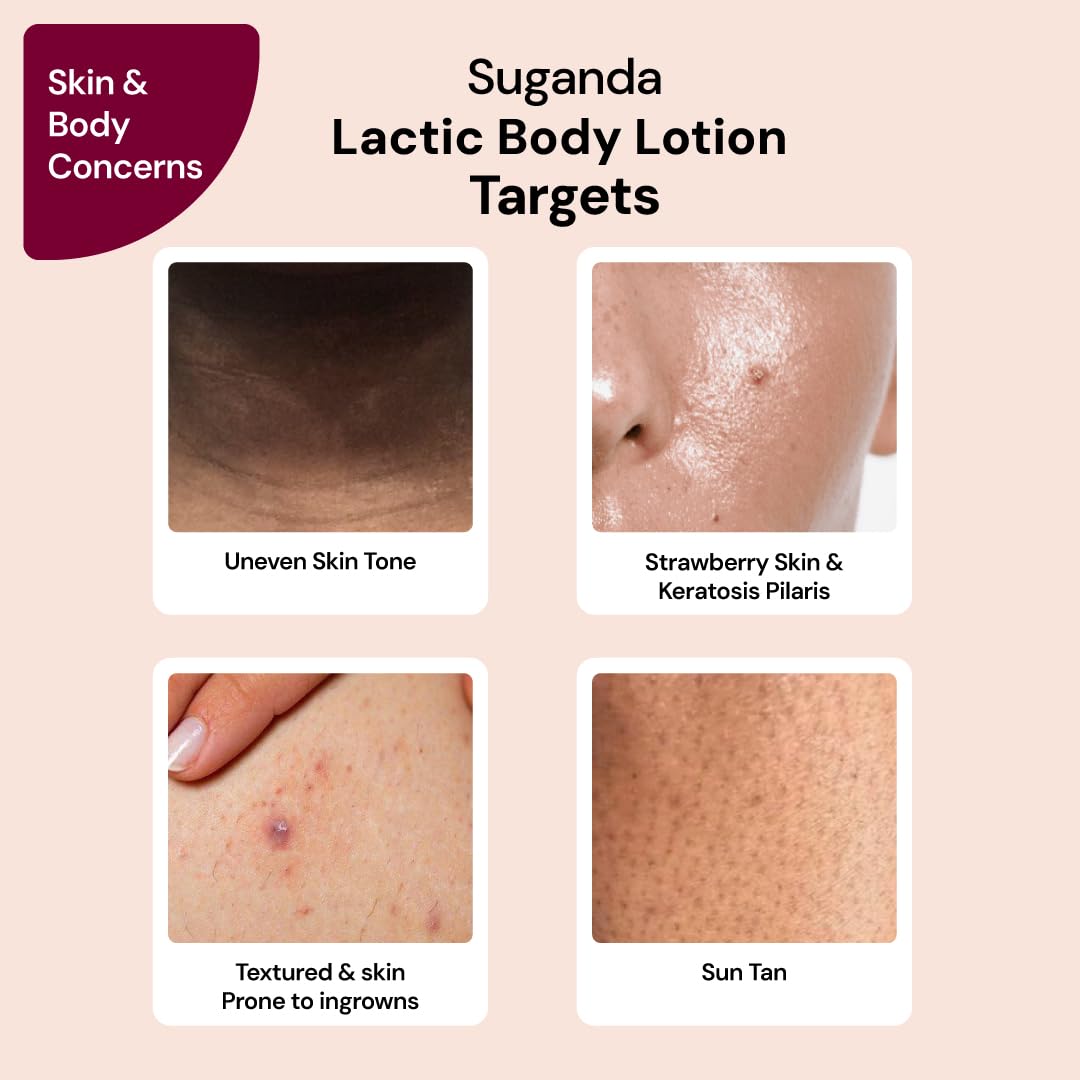 SUGANDA SKINCARE 5% Lactic acid UNSCENTED EXFOLIATING Body Lotion|Moisturizer with NIACINAMIDE, SHEA BUTTER & CALENDULA|For STRAWBERRY SKIN improving SKIN-TEXTURE & BRIGHTENING (500ml)|Cruelty-free 1