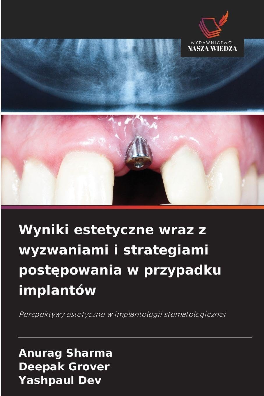 Wyniki estetyczne wraz z wyzwaniami i strategiami postępowania w przypadku implantów: Perspektywy estetyczne w implantologii stomatologicznej