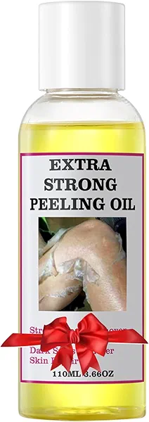 Yellow Peeling Oil for Dark Skin Strong Peel Oil Extra Strength Exfoliating Chemical Exfoliant Peels Solution at Home Body peeling for Exfoliate Body Hand Foot Dark Knuckle All Skin Type 3.66 OZ