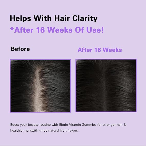 Hair Growth Gummies,Hair Growth Biotin Soft Chews Vitamins with Biotin,Mixed Berry Flavor,to Promote Thicker,Fuller,Stronger Hair For Men and Women,60 Count
