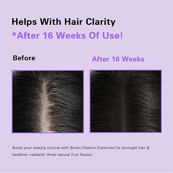 Hair Growth Gummies,Hair Growth Biotin Soft Chews Vitamins with Biotin,Mixed Berry Flavor,to Promote Thicker,Fuller,Stronger Hair For Men and Women,60 Count